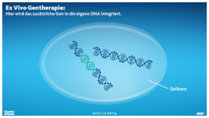 Ex-Vivo_v2 Ex Vivo Gentherapie: Hier wird das zusätzliche Gen in die eigene DNA integriert.