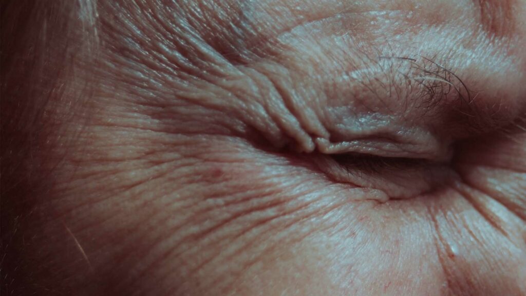 Geschlossenes Auge mit vielen Fältchen.