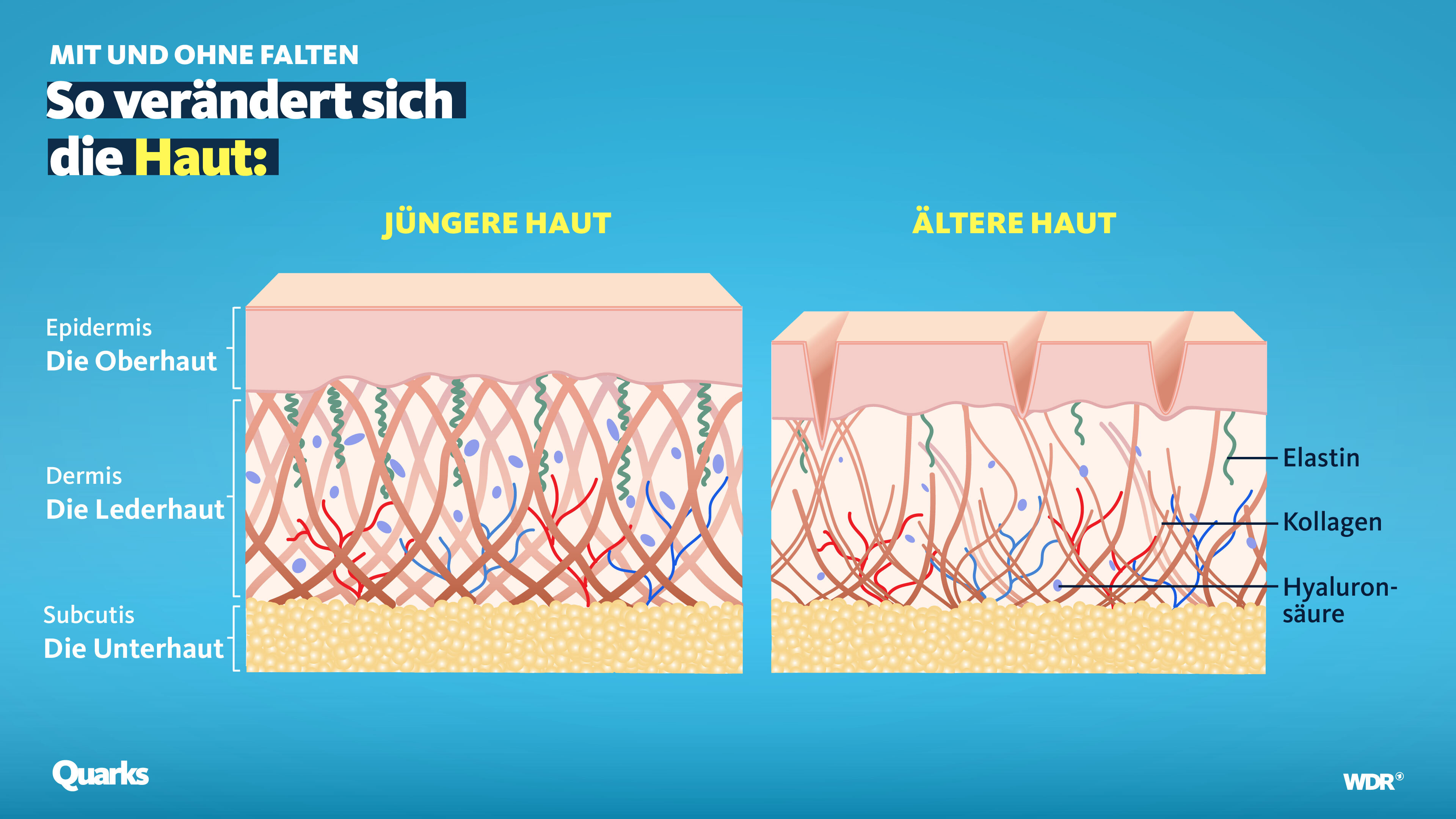 Grafik mit alter und junger Haut