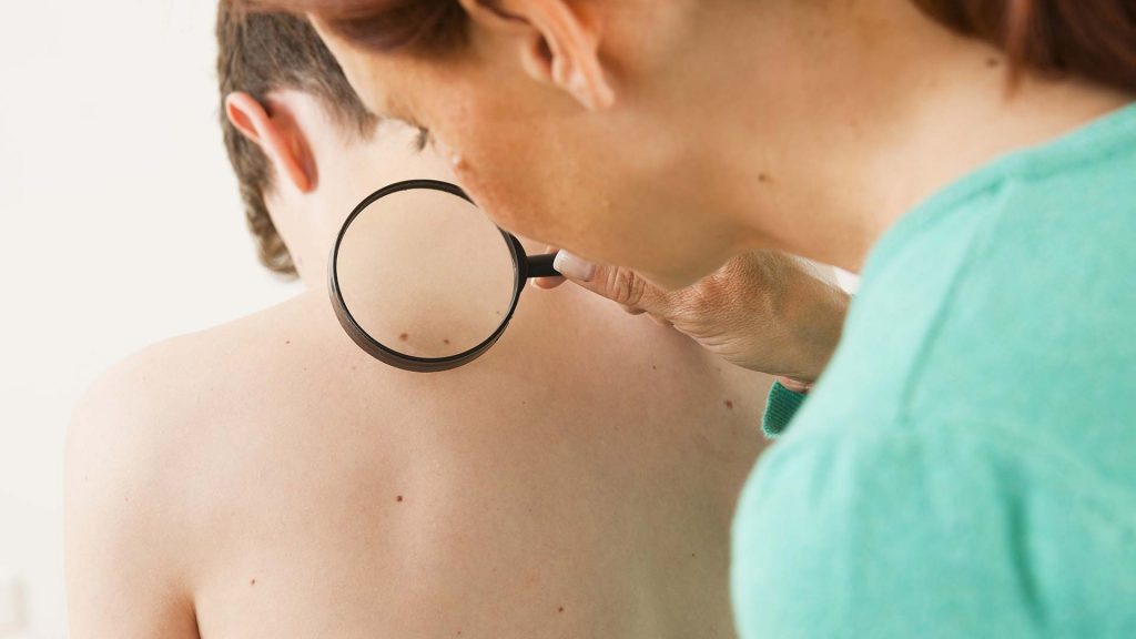 Teenager wird von einer Hautärztin untersucht.