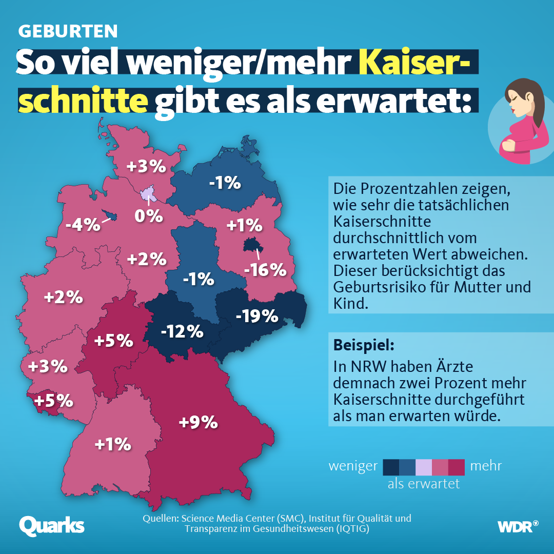 Veränderung der Kaiserschnitt-Eingriffe Veränderung der Kaiserschnitte auf Deutschland gesehen