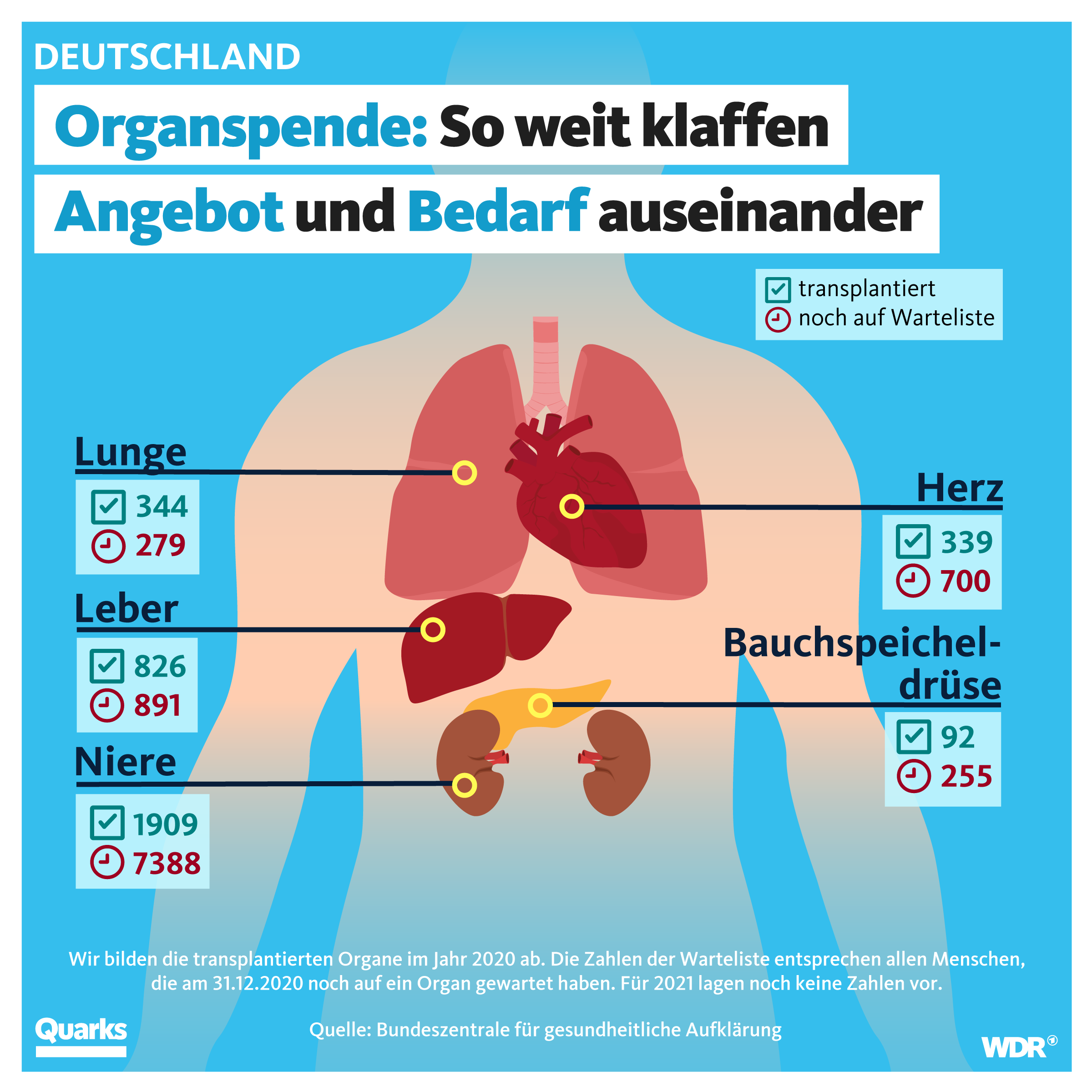 Grafik. Organspende: So weit klaffen Angebot und Bedarf auseinander. Grafik: WDR