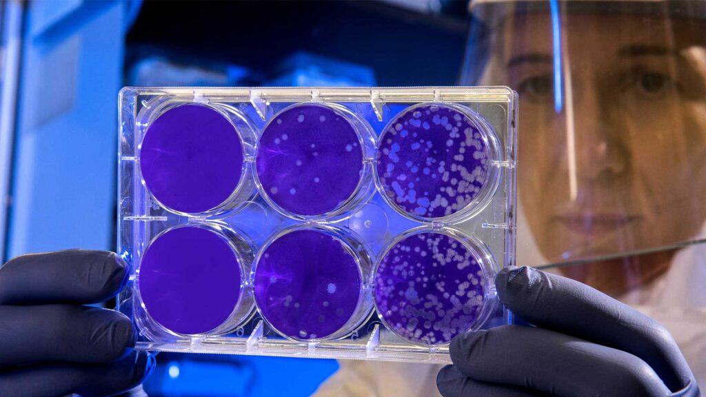 Eine Wissenschaftlerin in Schutzkleidung hält eine transparente Zellkulturplatte mit sechs runden, violetten Nährböden, teils mit Bakterienkolonien.
