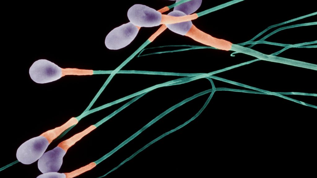 Spermien.